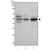 Western blot testing of 1) human HepG2, 2) human Caco-2 and 3) mouse HEPA1-6 cell lysate with Apolipoprotein H antibody. Predicted molecular weight ~38 kDa, but may be observed at higher molecular weights due to glycosylation.