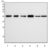 Western blot testing of 1) human K562, 2) human 293T, 3) human A431, 4) human Caco-2, 5) rat heart and 6) mouse heart tissue lysate with UCHL3 antibody. Predicted molecular weight ~26 kDa.