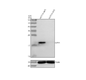 Immunoprecipitation of GPX4 protein from 500ug of human HCT-116 whole cell lysate with 2ug of GPX4 antibody.