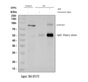 Immunoprecipitation of DEAD box protein 1 protein from 500ug of human SH-SY5Y whole cell lysate with 2ug of DEAD box protein 1 antibody.