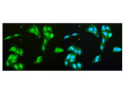 Immunofluorescent staining of FFPE human U-2 OS cells with DEAD box protein 1 antibody (green, left and right) and DAPI nuclear stain (blue, right). HIER: steam section in pH6 citrate buffer for 20 min.