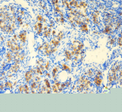 IHC staining of FFPE mouse ovary tissue with DEAD box protein 1 antibody, HRP-secondary and DAB substrate. HIER: boil tissue sections in pH8 EDTA for 20 min and allow to cool before testing.