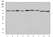Western blot testing of 1) human Raji, 2) human HeLa, 3) human HEK293, 4) human HepG2, 5) human K562, 6) rat liver, 7) rat pancreas, 8) mouse liver and 9) mouse pancreas tissue lysate with CBS antibody. Predicted molecular weight ~61 kDa.