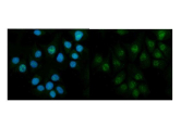 Immunofluorescent staining of FFPE human MCF7 cells with CBS antibody (green) and DAPI nuclear stain (blue). HIER: steam section in pH6 citrate buffer for 20 min.