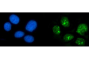 Immunofluorescent staining of FFPE human HeLa cells with HPD antibody (green) and DAPI nuclear stain (blue). HIER: steam section in pH6 citrate buffer for 20 min.