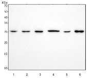 Western blot testing of 1) human SH-SY5Y, 2) human U-251, 3) human HepG2, 4) rat brain, 5) rat C6 and 6) mouse brain tissue lysate with Neurogenin 1 antibody. Predicted molecular weight ~26 kDa.