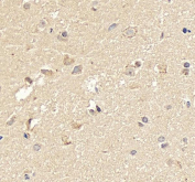 IHC staining of FFPE human brain tissue with Neurogenin 1 antibody, HRP-secondary and DAB substrate. HIER: boil tissue sections in pH8 EDTA for 20 min and allow to cool before testing.