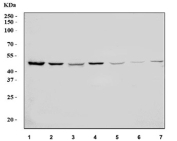 Western blot testing of 1) human HepG2, 2) human HeLa, 3) human MCF7, 4) human 293T, 5) rat brain, 6) rat C6 and 7) mouse brain tissue lysate with AP2M1 antibody. Predicted molecular weight ~50 kDa.