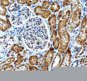IHC staining of FFPE human kidney tissue with AP2M1 antibody, HRP-secondary and DAB substrate. HIER: boil tissue sections in pH8 EDTA for 20 min and allow to cool before testing.