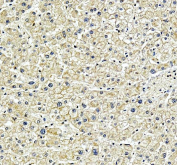 IHC staining of FFPE human liver tissue with SPRED2 antibody, HRP-secondary and DAB substrate. HIER: boil tissue sections in pH8 EDTA for 20 min and allow to cool before testing.