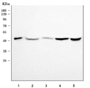 Western blot testing of 1) human A549, 2) rat brain, 3) rat C6, 4) mouse brain and 5) mouse RAW264.7 cell lysate with SNX6 antibody. Predicted molecular weight ~47 kDa.
