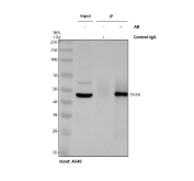 Immunoprecipitation of SNX6 protein from 500ug of human A549 whole cell lysate with 2ug of SNX6 antibody.