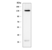 Western blot testing of human K562 cell lysate with STON2 antibody. Predicted molecular weight ~101 kDa but is often observed at ~130 kDa.