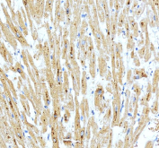 IHC staining of FFPE human heart tissue with SPAG7 antibody, HRP-secondary and DAB substrate. HIER: boil tissue sections in pH8 EDTA for 20 min and allow to cool before testing.
