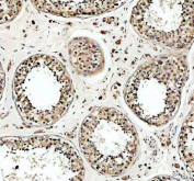 IHC staining of FFPE human testis tissue with USP5 antibody, HRP-secondary and DAB substrate. HIER: boil tissue sections in pH8 EDTA for 20 min and allow to cool before testing.