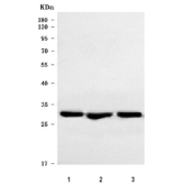 Western blot testing of human 1) MCF7, 2) HeLa and 3) A549 cell lysate with NQO1 antibody. Predicted molecular weight ~30 kDa.
