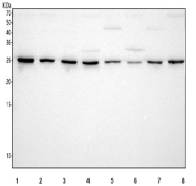 Western blot testing of 1) human HeLa, 2) human HepG2, 3) human 293T, 4) monkey COS-7, 5) rat brain, 6) rat PC-12, 7) mouse brain and 8) mouse Neuro-2a cell lysate with PSMA5 antibody. Predicted molecular weight ~26 kDa.