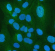 Immunofluorescent staining of FFPE human U-2 OS cells with PSMA5 antibody (green) and DAPI nuclear stain (blue). HIER: steam section in pH6 citrate buffer for 20 min.