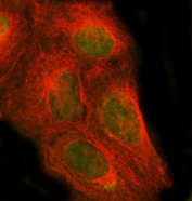 Immunofluorescent staining of FFPE human U-2 OS cells with PSMC1 antibody (green) and Beta Tubulin mAb (red). HIER: steam section in pH6 citrate buffer for 20 min.