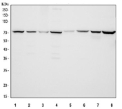 Western blot testing of 1) human ThP-1, 2) human HEL, 3) human RT-4, 4) human SiHa, 5) rat small intestine, 6) rat kidney, 7) mouse small intestine and 8) mouse kidney tissue lysate with CPT2 antibody. Predicted molecular weight ~74 kDa.