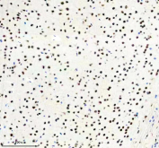 IHC staining of FFPE mouse brain tissue with PABPN1 antibody, HRP-secondary and DAB substrate. HIER: boil tissue sections in pH8 EDTA for 20 min and allow to cool before testing.