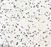 IHC staining of FFPE rat brain tissue with PABPN1 antibody, HRP-secondary and DAB substrate. HIER: boil tissue sections in pH8 EDTA for 20 min and allow to cool before testing.