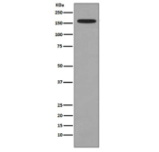 Western blot testing of mouse RAW264.7 cell lysate with DOT1L antibody. Predicted molecular weight ~165 kDa.