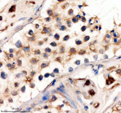 IHC staining of FFPE human testis tissue with DOT1L antibody, HRP-secondary and DAB substrate. HIER: boil tissue sections in pH8 EDTA for 20 min and allow to cool before testing.