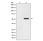 Western blot testing of 1) lysate from human SH-SY5Y cells and 2) lysate from human SH-SY5Y cells treated with Okadaic acid and Calyculin A, using Phospho-Tau antibody.