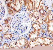 IHC staining of FFPE human kidney tissue with Phospho-Tau antibody, HRP-secondary and DAB substrate. HIER: boil tissue sections in pH8 EDTA for 20 min and allow to cool before testing.