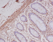 IHC staining of FFPE human colon tissue with ACTA2 antibody, HRP-secondary and DAB substrate. HIER: boil tissue sections in pH8 EDTA for 20 min and allow to cool before testing.