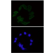Immunofluorescent staining of FFPE human HeLa cells with Alpha Actin antibody (green) and DAPI nuclear stain (blue). HIER: steam section in pH6 citrate buffer for 20 min.