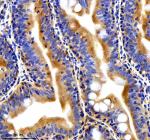 Immunohistochemical analysis of Ttc28 protein using Ttc28 antibody and paraffin-embedded zebrafish colon tissue. HIER: boil tissue sections in pH8 EDTA for 20 min and allow to cool before testing.