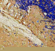 IHC staining of FFPE zebrafish brain tissue with Zebrafish Rab3Gap1 antibody. HIER: boil tissue sections in pH8 EDTA for 20 min and allow to cool before testing.