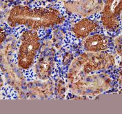 IHC staining of FFPE zebrafish kidney tissue with Zebrafish Rab3Gap1 antibody. HIER: boil tissue sections in pH8 EDTA for 20 min and allow to cool before testing.