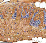 IHC staining of FFPE zebrafish heart tissue with Zebrafish Rab3Gap1 antibody. HIER: boil tissue sections in pH8 EDTA for 20 min and allow to cool before testing.