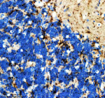 Immunohistochemical analysis of Hrasa/b protein using Zebrafish Hras antibody and paraffin-embedded zebrafish cerebellum tissue. HIER: boil tissue sections in pH8 EDTA for 20 min and allow to cool before testing.