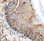IHC staining of FFPE zebrafish esophagus tissue with Zebrafish Gipc1 antibody. HIER: boil tissue sections in pH8 EDTA for 20 min and allow to cool before testing.
