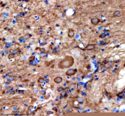 Immunohistochemical analysis of Stip1 protein using Zebrafish Stip1 antibody and paraffin-embedded zebrafish brain tissue. HIER: boil tissue sections in pH8 EDTA for 20 min and allow to cool before testing.