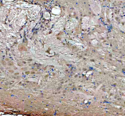 IHC staining of FFPE zebrafish brain tissue with Zebrafish Gbf1 antibody. HIER: boil tissue sections in pH8 EDTA for 20 min and allow to cool before testing.