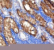 Immunohistochemical analysis of Vps53 protein using Vps53 antibody and paraffin-embedded zebrafish kidney tissue. HIER: boil tissue sections in pH8 EDTA for 20 min and allow to cool before testing.
