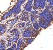 IHC staining of FFPE zebrafish testis tissue with Zebrafish Ash2l antibody, HRP secondary and DAB substrate. HIER: boil tissue sections in pH8 EDTA for 20 min and allow to cool before testing.
