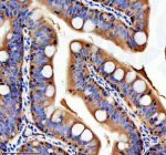 IHC staining of zebrafish Tgfb1 protein using Zebrafish Tgfb1 antibody, HRP-labeled secondary and DAB substrate. Tgfb1 was detected in a paraffin-embedded section of zebrafish colon tissue. HIER: boil tissue sections in pH8 EDTA for 20 min and allow to cool before testing.
