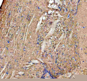 IHC staining of zebrafish Kita protein using Zebrafish Kita antibody, HRP-labeled secondary and DAB substrate. Kita was detected in a paraffin-embedded section of zebrafish brain tissue. HIER: boil tissue sections in pH8 EDTA for 20 min and allow to cool before testing.