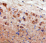 IHC staining of zebrafish Lhcgr protein using Zebrafish Lhcgr antibody, HRP-labeled secondary and DAB substrate. Lhcgr was detected in a paraffin-embedded section of zebrafish brain tissue. HIER: boil tissue sections in pH8 EDTA for 20 min and allow to cool before testing.