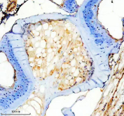 IHC staining of FFPE zebrafish spinal column tissue with Zebrafish Mmp13a antibody, HRP-labeled secondary and DAB substrate. HIER: boil tissue sections in pH8 EDTA for 20 min and allow to cool before testing.