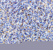 IHC staining of zebrafish Igf2a protein using Zebrafish Igf2a antibody, HRP-labeled secondary and DAB substrate. Igf2a was detected in a paraffin-embedded section of zebrafish liver tissue. HIER: boil tissue sections in pH8 EDTA for 20 min and allow to cool before testing.