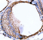 IHC staining of FFPE zebrafish inner ear tissue with Zebrafish E-cadherin antibody, HRP-labeled secondary and DAB substrate. HIER: boil tissue sections in pH8 EDTA for 20 min and allow to cool before testing.