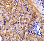 IHC staining of FFPE zebrafish kidney tissue with Zebrafish E-cadherin antibody, HRP-labeled secondary and DAB substrate. HIER: boil tissue sections in pH8 EDTA for 20 min and allow to cool before testing.