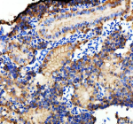 IHC staining of FFPE zebrafish kidney tissue with Zebrafish E-cadherin antibody, HRP-labeled secondary and DAB substrate. HIER: boil tissue sections in pH8 EDTA for 20 min and allow to cool before testing.